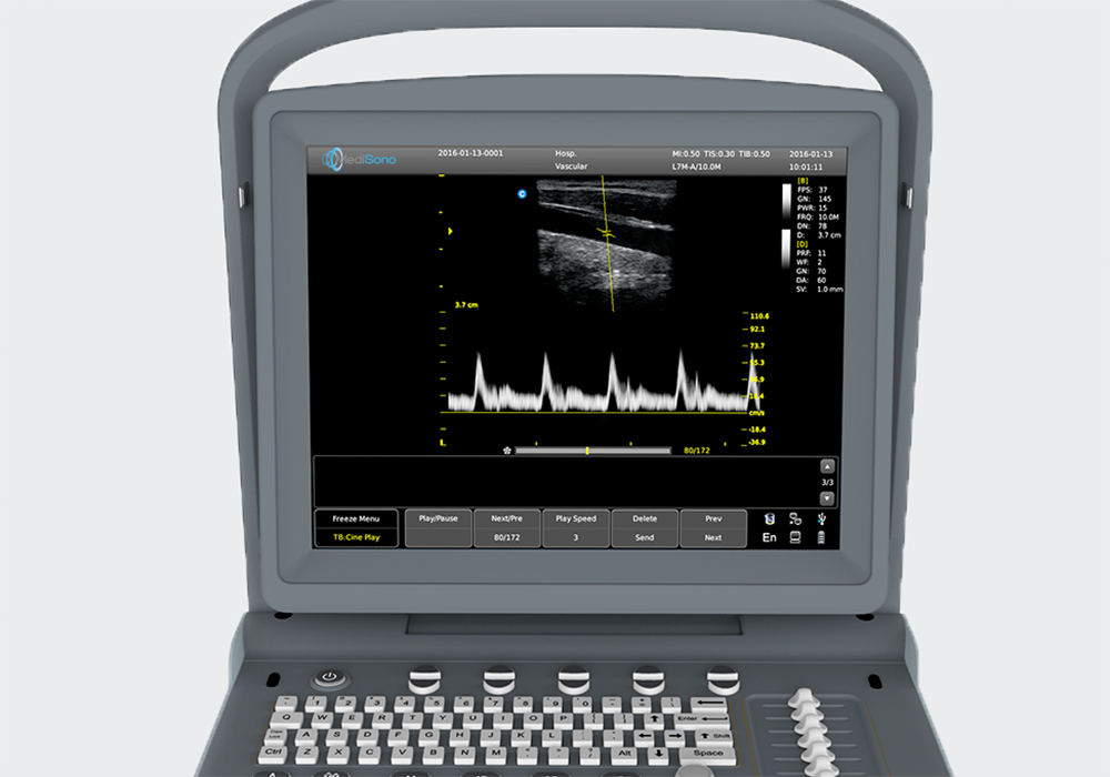 Medisono系列超音波